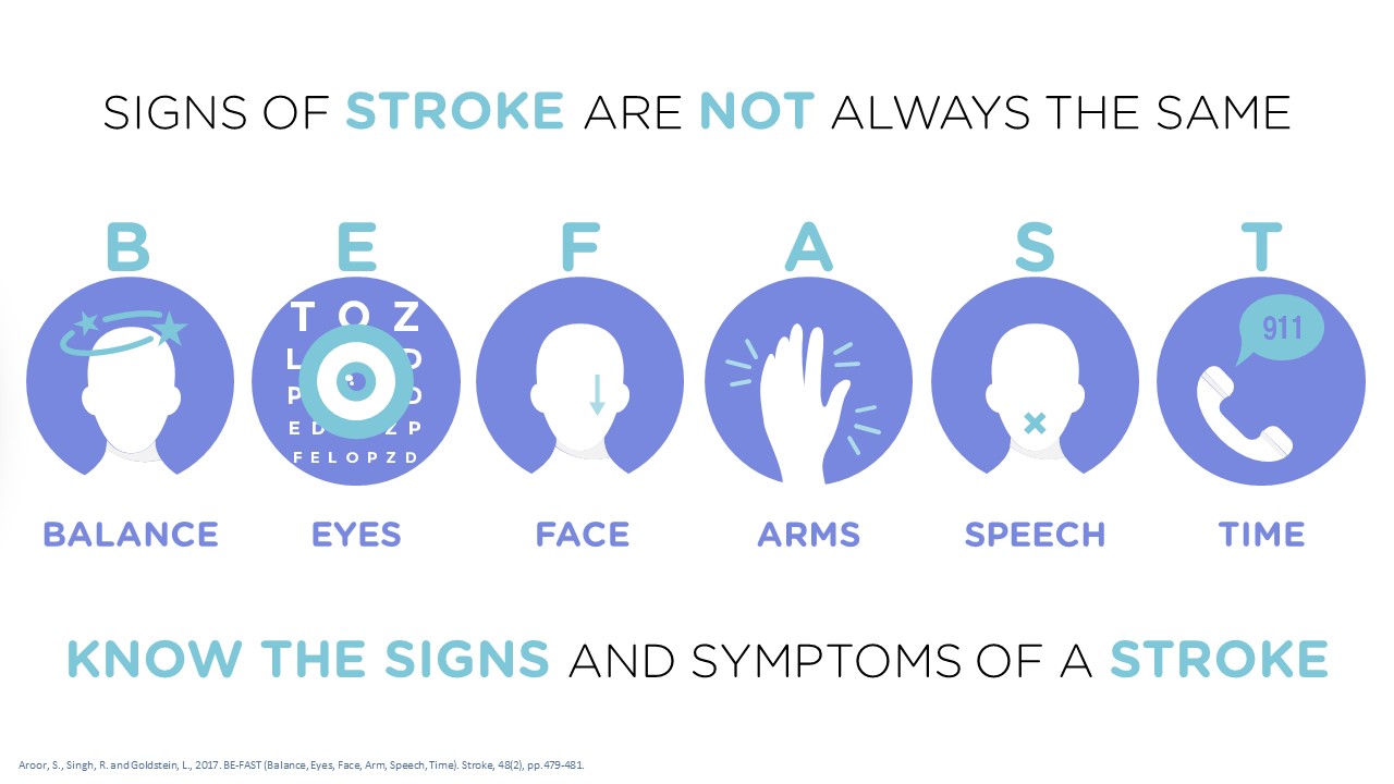 Signs of stroke diagram