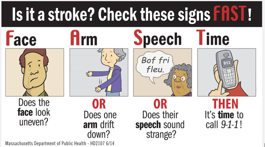 Had a stroke. To stroke. Arm Drift stroke. Mrs Scale stroke. Fast accident Vascular cerebral.