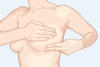 How to Perform a Breast Self-Exam